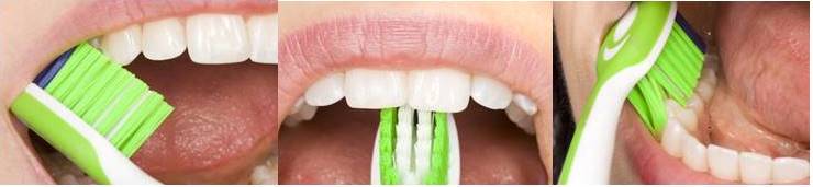 COVID-19: Recomendaciones para tu salud dental