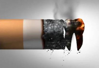 Dejar de fumar disminuye el riesgo de perder dientes.